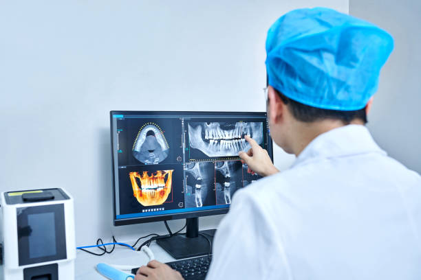 Best Dental Abscess Treatment in Pinecrest, FL